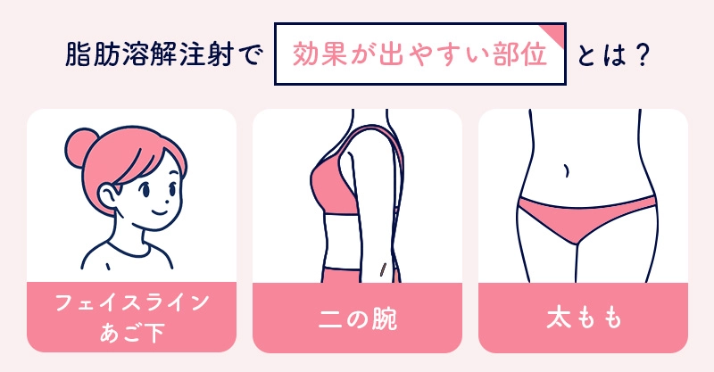 脂肪溶解注射の効果が出やすい部位
