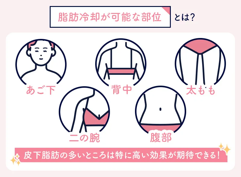 脂肪冷却可能な部位