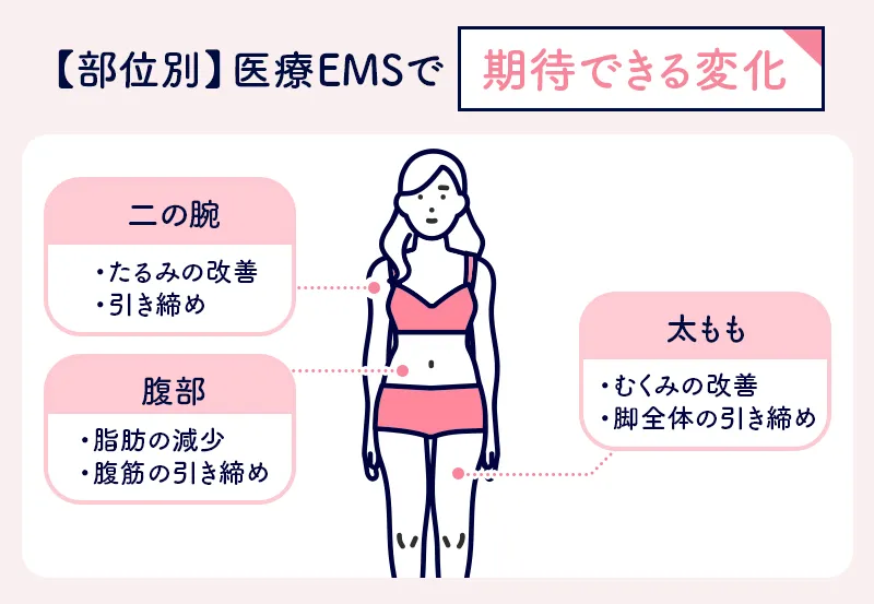 部位別で医療EMSの施術が発揮する効果