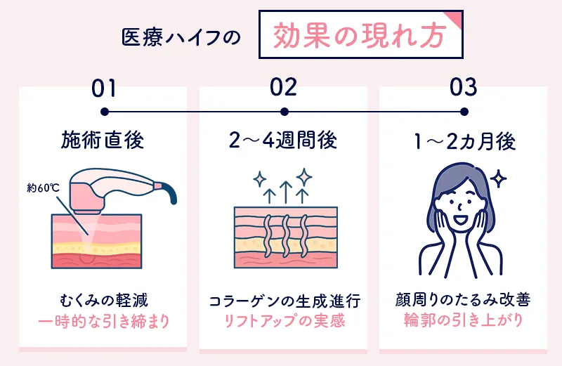 医療ハイフの施術後に感じられる効果