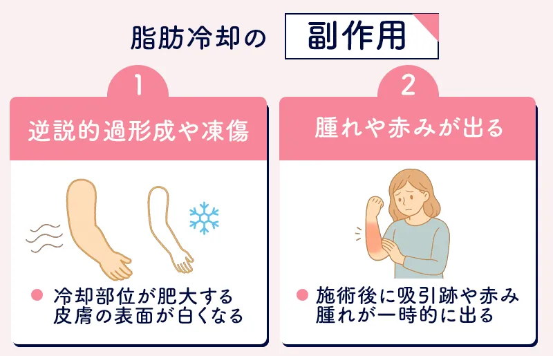 脂肪冷却による副作用