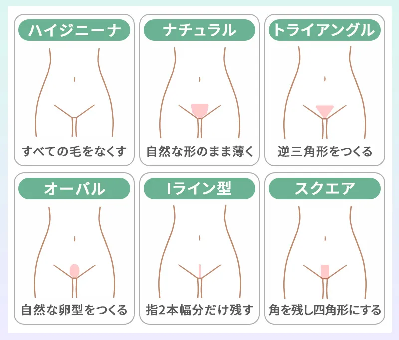 VIO脱毛で選べるデザインの基本の種類