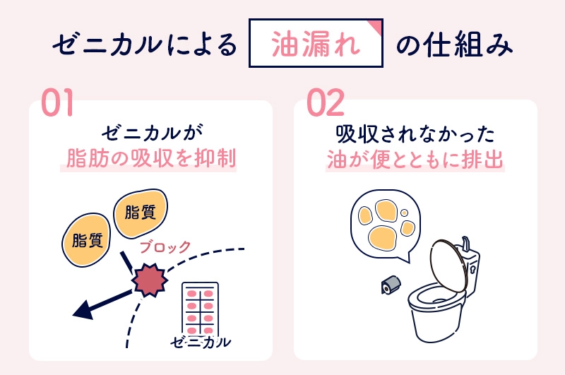 ゼニカルで油漏れが起こる原因